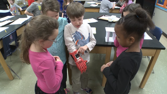 Lucas Abraham, who was born without fingers on his right hand, shows classmates his 'robo-hand.'