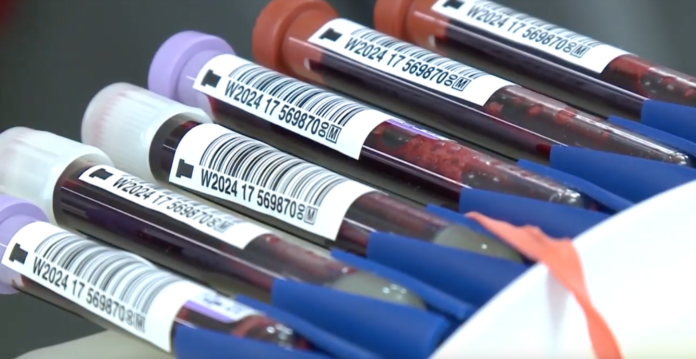 UofL researchers are looking for ways to extend the shelf life of blood.