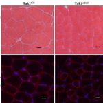 Photomicrographs showing transverse sections of control (Tak1fl/fl) and TAK1-inactivated (Tak1mKO) tibialis anterior muscle.