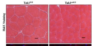 Photomicrographs showing transverse sections of control (Tak1fl/fl) and TAK1-inactivated (Tak1mKO) tibialis anterior muscle.