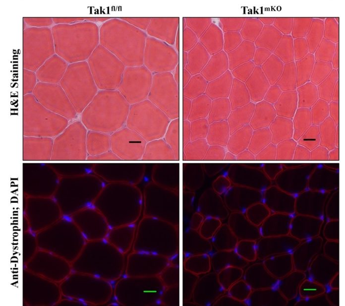 Control and TAK1-inactivated muscle Photomicrographs showing transverse sections of control (Tak1fl/fl) and TAK1-inactivated (Tak1mKO) tibialis anterior muscle.