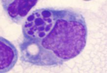 Image of macrophage digesting apoptotic, or dead cell