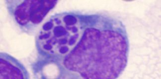 Image of macrophage digesting apoptotic, or dead cell