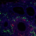 Immunomodulatory signal presentation via synthetic hydrogel material promotes generation of T regulatory cells (green) in the local graft microenvironment (CD3+ T cells in red, and nuclei staining in blue) after implantation into a clinically relevant transplant model for the treatment of type 1 diabetes. (Credit: Georgia Tech)