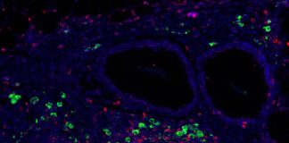 Immunomodulatory signal presentation via synthetic hydrogel material promotes generation of T regulatory cells (green) in the local graft microenvironment (CD3+ T cells in red, and nuclei staining in blue) after implantation into a clinically relevant transplant model for the treatment of type 1 diabetes. (Credit: Georgia Tech)