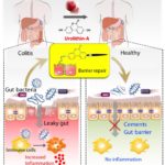 Illustration showing tightening of gut barrier cells and reduced inflammation due to UroA, by Praveen Kumar Vemula, Ph.D., Institute for Stem Cell Biology and Regenerative Medicine, India, and Venkatakrishna Jala, Ph.D., UofL