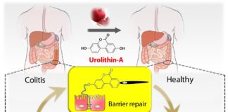 Illustration showing tightening of gut barrier cells and reduced inflammation due to UroA, by Praveen Kumar Vemula, Ph.D., Institute for Stem Cell Biology and Regenerative Medicine, India, and Venkatakrishna Jala, Ph.D., UofL