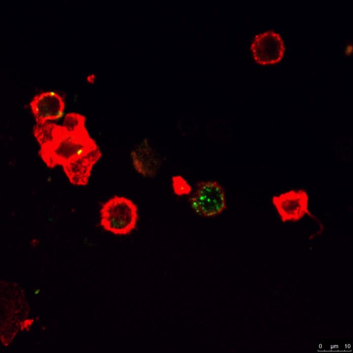 A confocal microscope image shows the SA-4-1BBL (green color) bound to its receptor on an immune cell (red color) to initiate an immune activation cascade to fight cancer. Image courtesy University of Louisville.