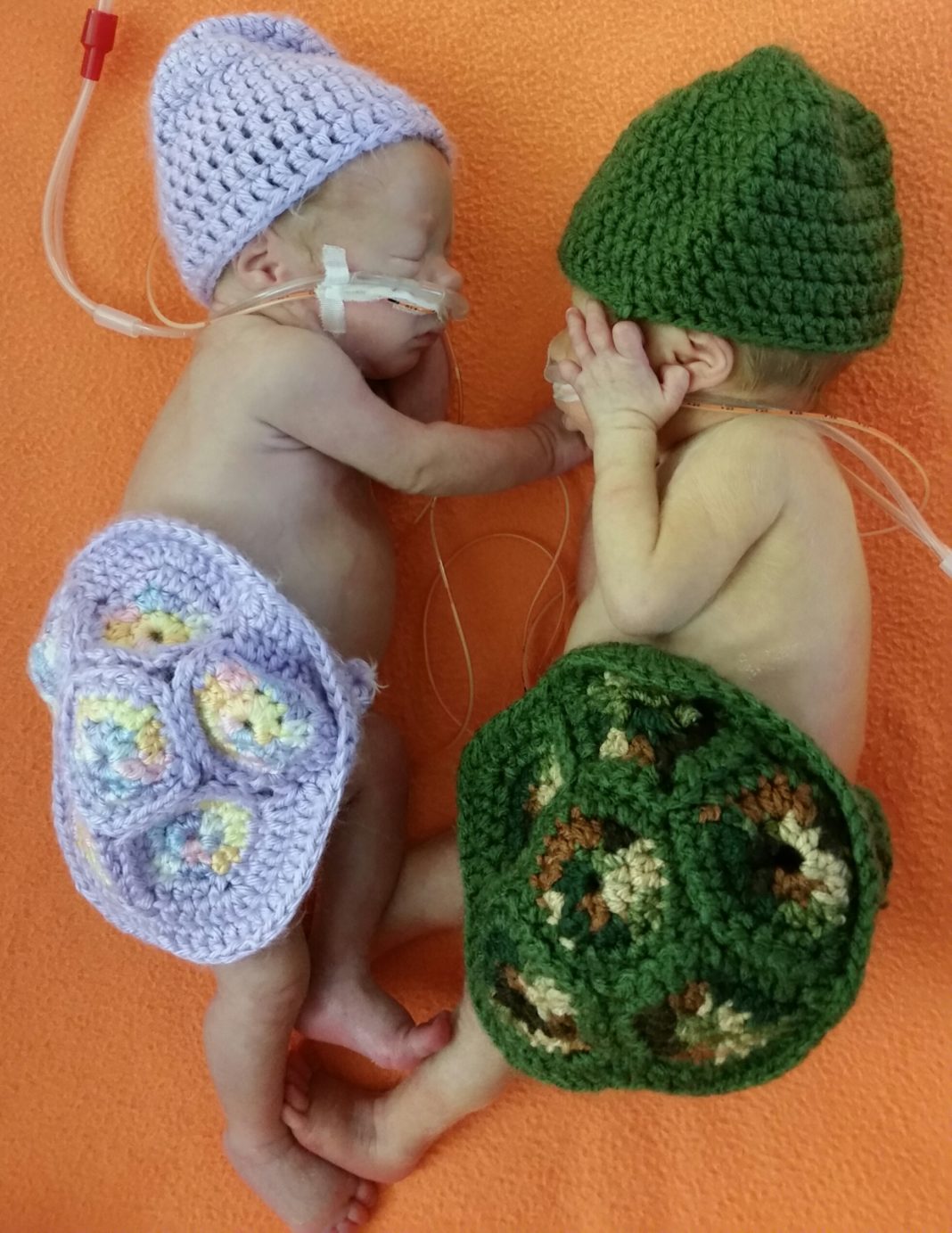 Coulter babies in the UofL Hospital NICU