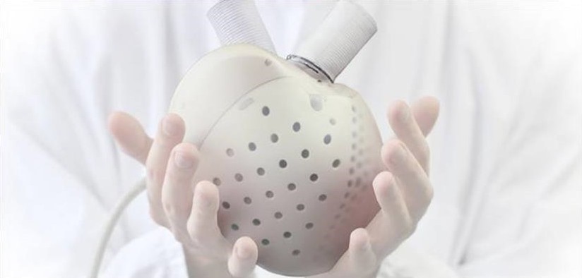 Aeson® total artificial heart. Image courtesy CARMAT. Aeson® total artificial heart. Image courtesy CARMAT.