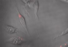 A live microscopy image of macrophages, white blood cells that mediate innate immunity, infected with Yersinia pestis, shown in red. UofL photo by Matthew Lawrenz and Tiva VanCleave, a former doctoral student in Lawrenz’s lab