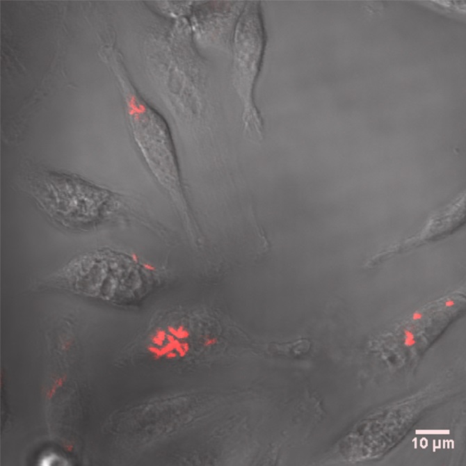 A live microscopy image of macrophages, white blood cells that mediate innate immunity, infected with Yersinia pestis, shown in red. UofL photo by Matthew Lawrenz and Tiva VanCleave, a former doctoral student in Lawrenz’s lab