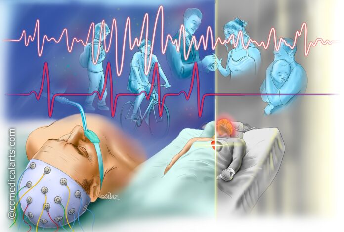 When we die, does our whole body die at the same time? - BBC Science Focus  Magazine