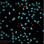 Confocal microscopy images taken in the Lawrenz lab of neutrophils (blue) and Yersinia pestis (red).