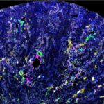 Mass spectrometry image of a kidney showing changes characteristic of chronic kidney disease. (Photo by Dana Hammouri)