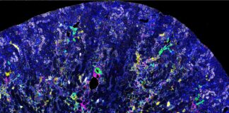 Mass spectrometry image of a kidney showing changes characteristic of chronic kidney disease. (Photo by Dana Hammouri)