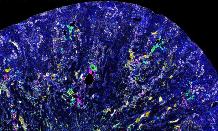 Mass spectrometry image of a kidney showing changes characteristic of chronic kidney disease. (Photo by Dana Hammouri)